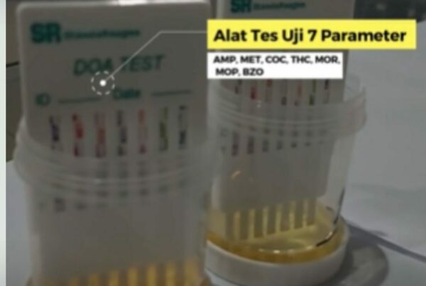 Tes Urine Dalam Rangka Deteksi Dini Kepada Karwayan PT. Reska Multi Usaha
